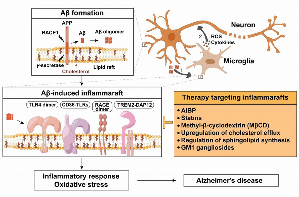 ALZHEIMER’S DISEASE