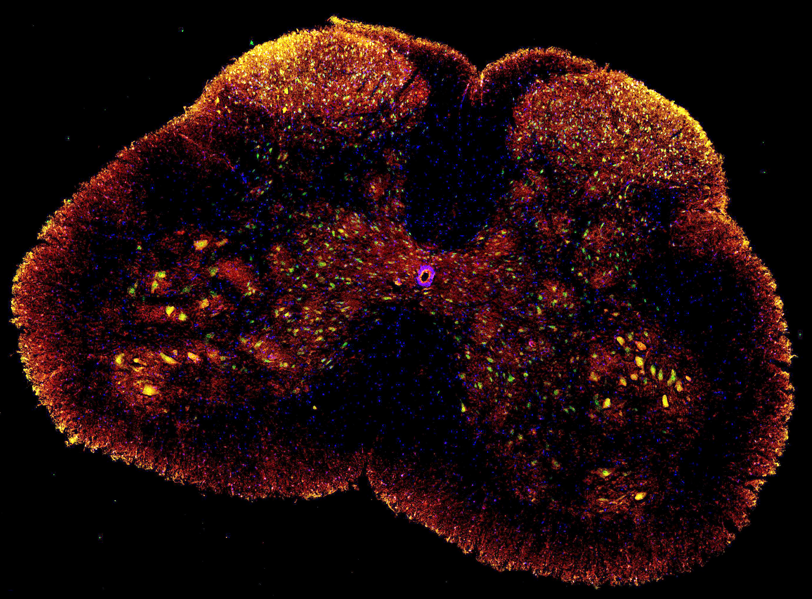 Spinal cord (credit: Juliana Navia Pelaez)